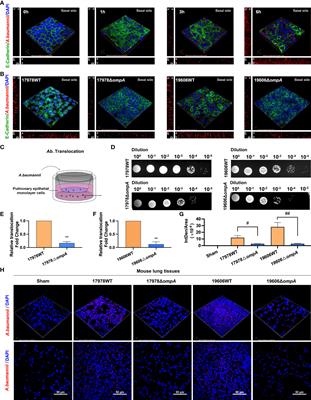 Acinetobacter baumannii Outer Membrane Protein A Induces Pulmonary Epithelial Barrier Dysfunction and Bacterial Translocation Through The TLR2/IQGAP1 Axis